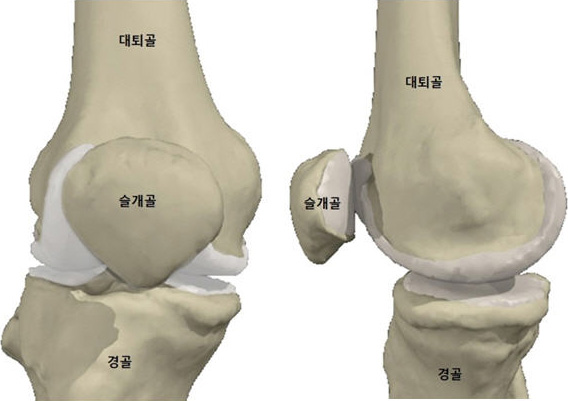 반월상 연골 파열1